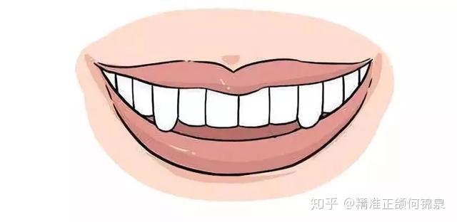 拔除虎牙还将影响到其他牙齿之间的位置关系